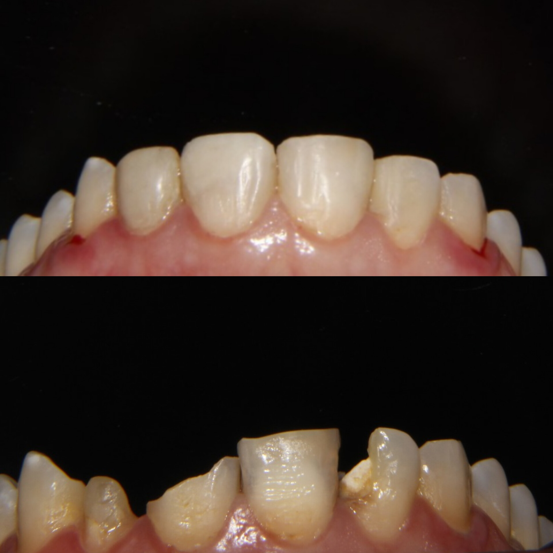 Antes y después de transformación estética